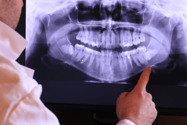 Best Emergency Broken Tooth Repair in Glenwood Landing, NY